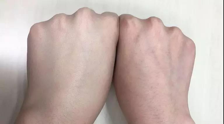 如何快速美白的辦法